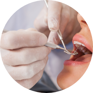 Mir Implant System image2